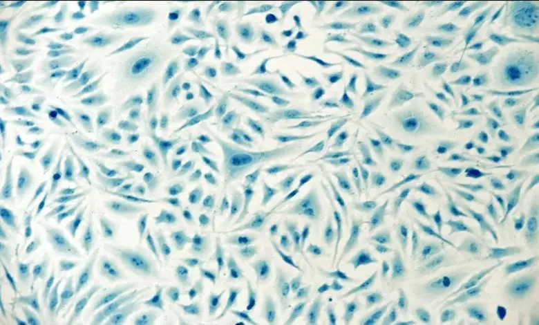 Henrietta Lacks ve Onun Ölümsüz HeLa Hücreleri Neden Önemlidir?